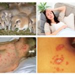 Maladies dérivées de souris