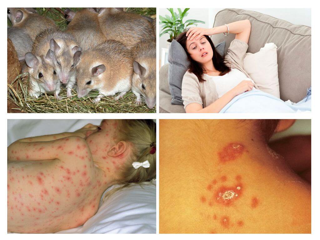 Maladies dérivées de souris