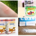 Les piqûres de moustiques qui démangent aideront à éliminer le sel et le soda au vinaigre