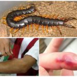 Danger de morsure de Scolopendra