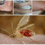 Piqûres d'insectes