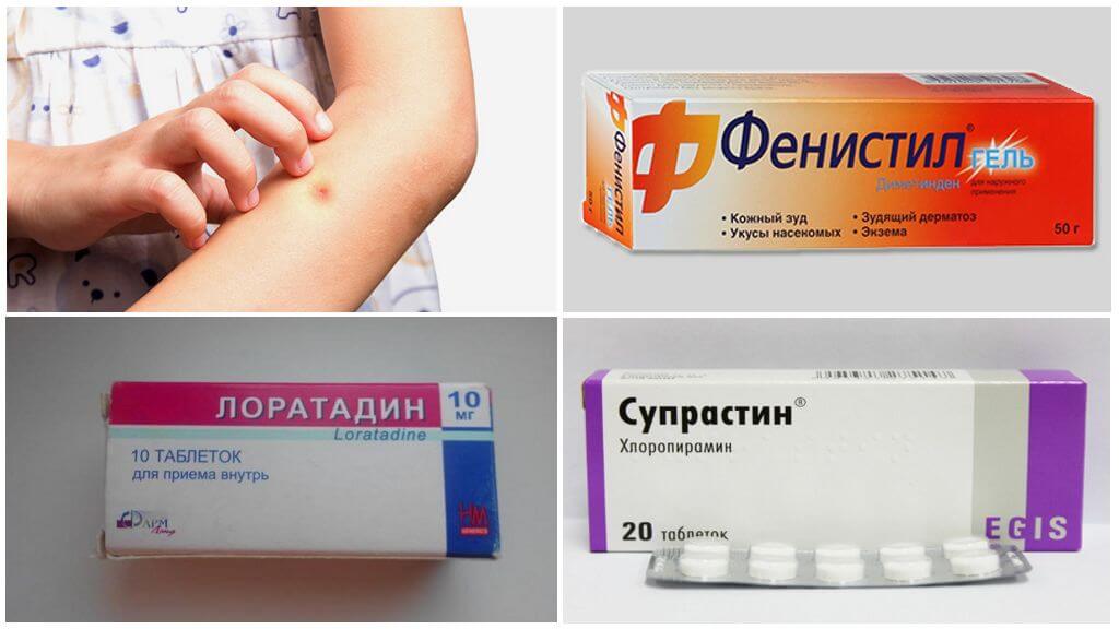 Médicaments contre l'allergie aux piqûres de moustiques