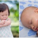 Les piqûres de moustiques chez les enfants