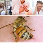 Les effets d'une piqûre d'abeille