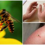 Piqûre d'abeille