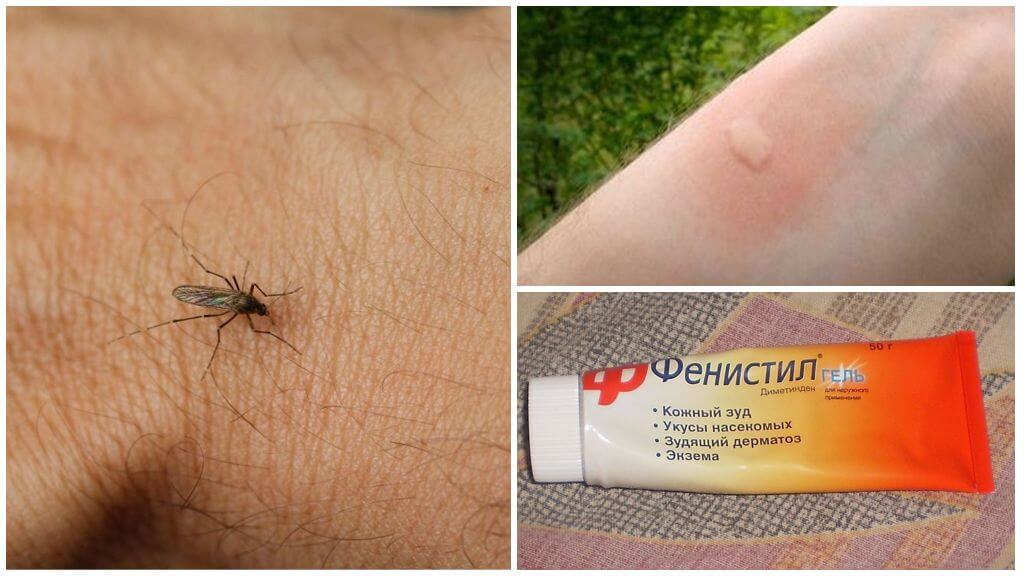 Fenistil de piqûres de moustiques