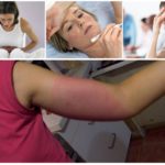 Les effets d'une piqûre d'abeille