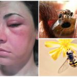 Abeille pique dans les yeux