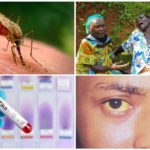 Virus Zika, virus du Nil occidental et fièvre jaune