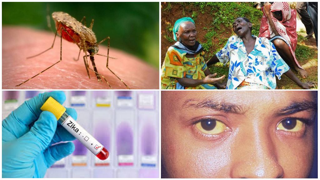 Virus Zika, virus du Nil occidental et fièvre jaune