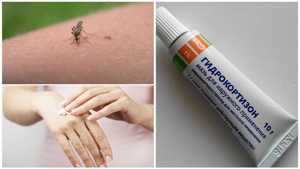 Pommade à l'hydrocortisone pour les piqûres de moustiques