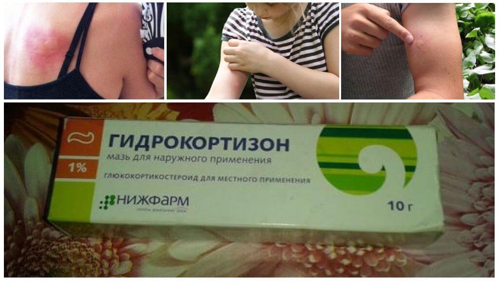 Indications d'utilisation pommade Hydrocortisone