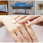 Piqûres de moustiques hormonales