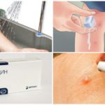 Actions de morsure d'insecte