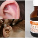Moustique a volé dans l'oreille
