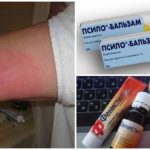Traitement des pieds enflés avec des antihistaminiques