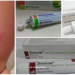 Traitement des complications de la morsure
