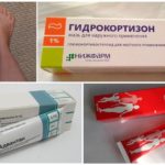 Traitement de l'oedème avec des médicaments hormonaux