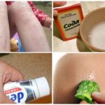 Remèdes populaires contre les piqûres de moustiques