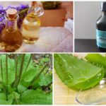 Remèdes populaires contre les piqûres de moustiques