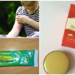 Remèdes contre les piqûres de moustiques