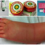 Traitement de l'enflure des jambes avec des remèdes naturels