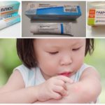 Pommades utilisées dans les piqûres de moustiques chez les enfants