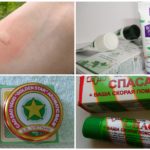 Traitement de piqûre de moustique