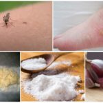 Remèdes populaires pour les ampoules