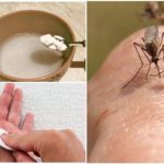 Les piqûres de moustiques soude