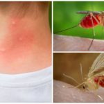 Piqûres d'insectes