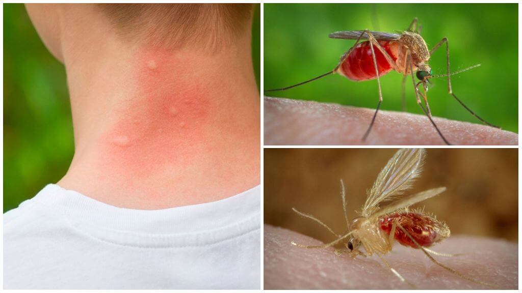 Piqûres d'insectes