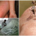 Dengue et fièvre du moustique Chikungunya