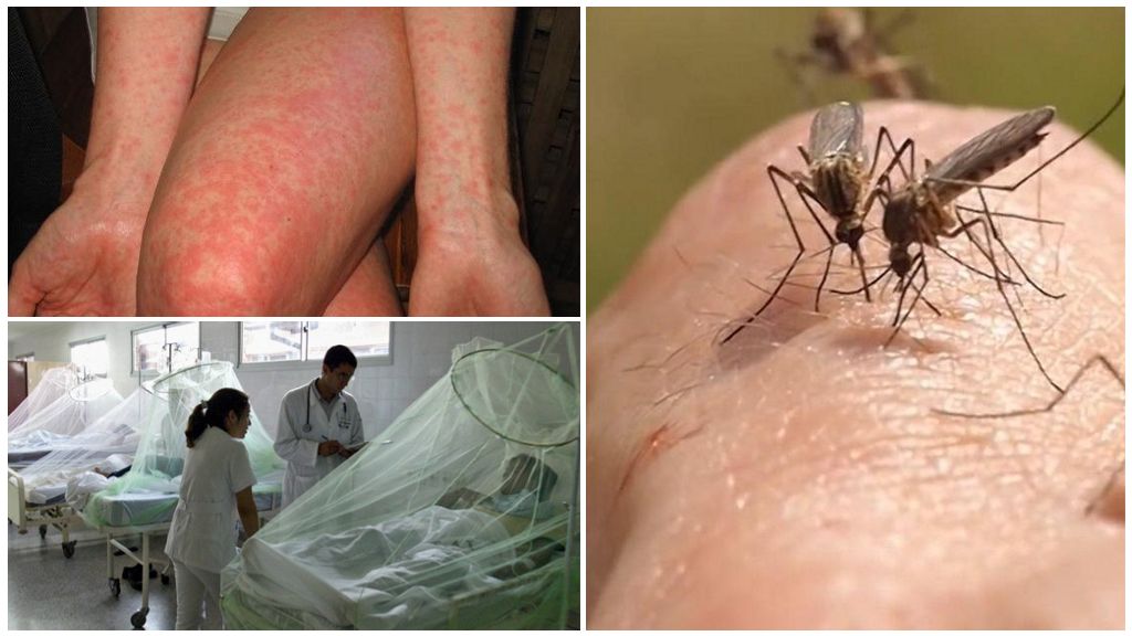 Dengue et fièvre du moustique Chikungunya