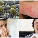 Allergie aux acariens