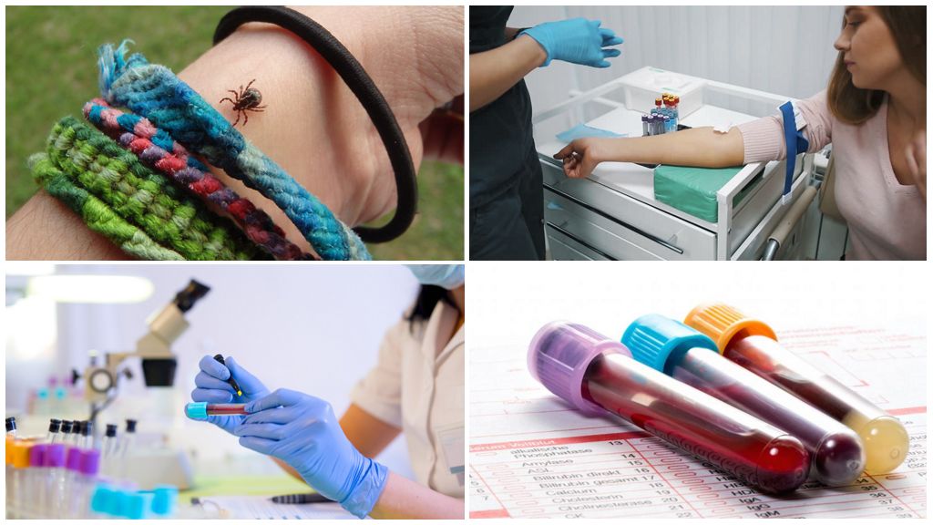 Analyse des morsures de tiques