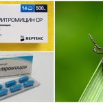 Antibiotiques après une piqûre de tique