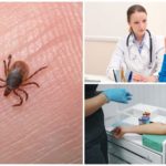 Diagnostic de l'ehrlichiose monocytaire chez l'homme