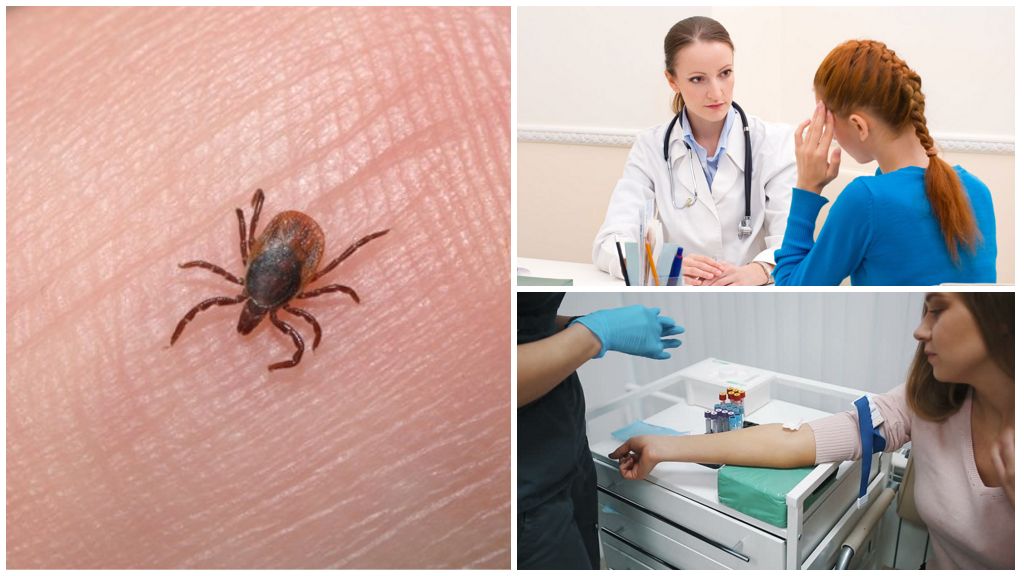 Diagnostic de l'ehrlichiose monocytaire chez l'homme