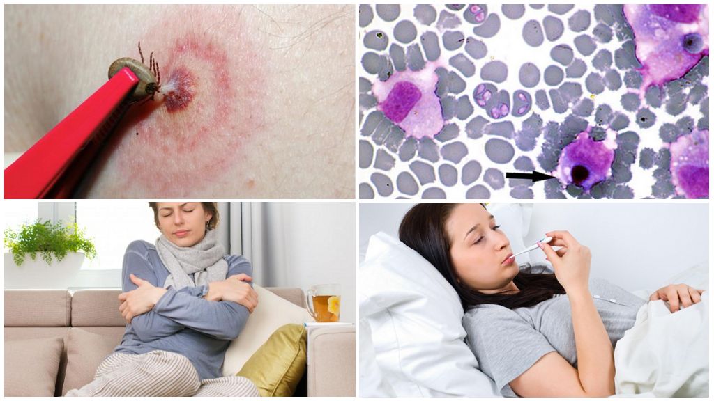 Ehrlichiose monocytaire chez l'homme