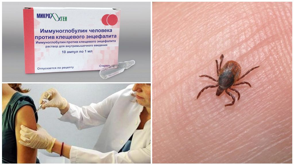Immunoglobuline contre l'encéphalite à tiques