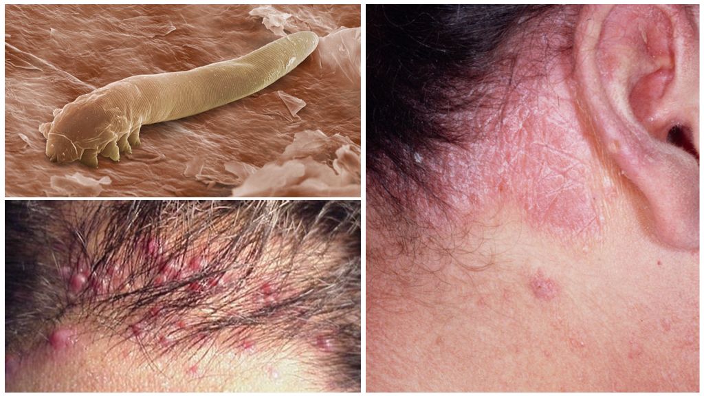 Cheveux mites sur le cuir chevelu