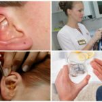 Traitement complet des acariens