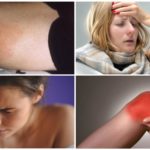 Symptômes négatifs après une morsure de tique
