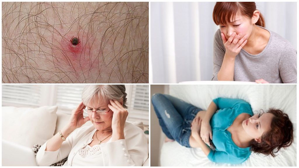 Premiers signes de maladies transmises par les tiques
