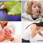 Symptômes de l'encéphalite à tiques chez les adultes