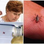 Retrait des tiques