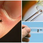 Remettre le tick pour analyse