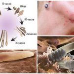 Demodex à différentes étapes de développement