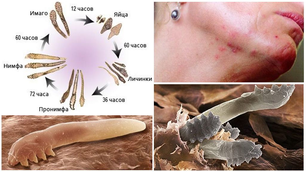 Demodex à différentes étapes de développement